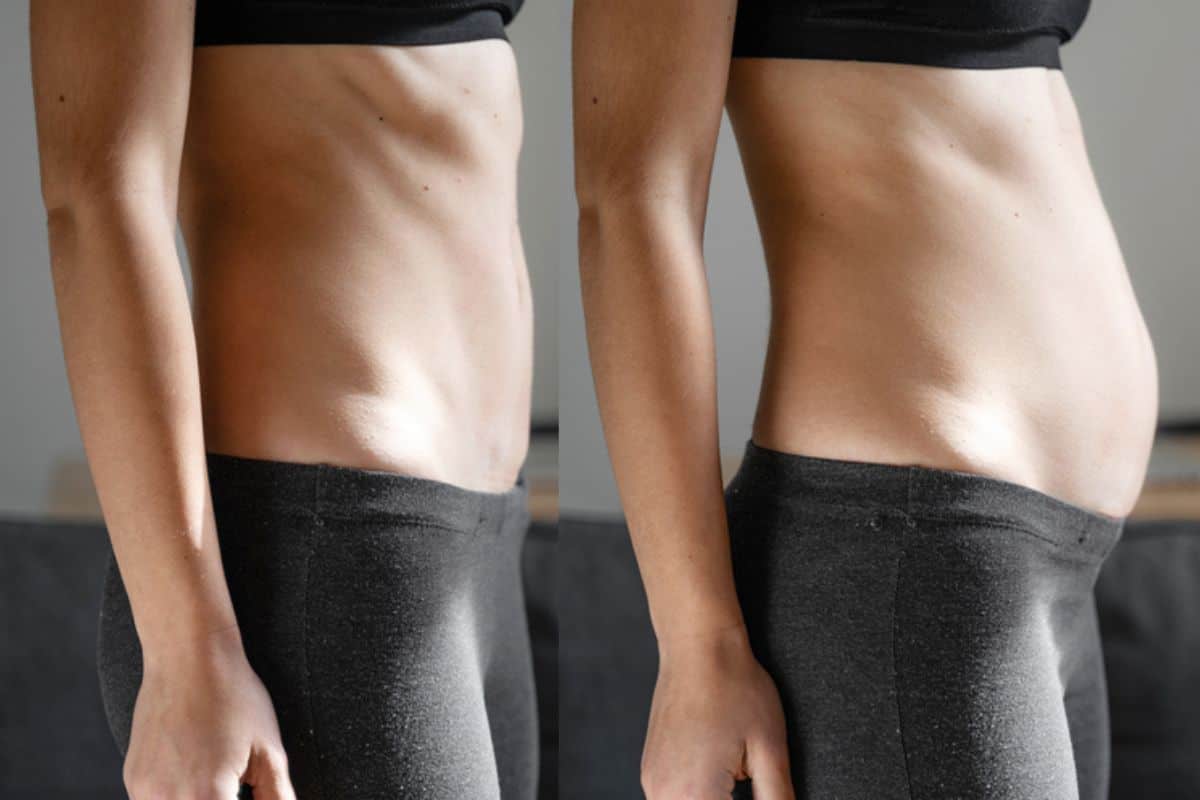 How long does diastasis recti take to improve Greater London (Sutton)?