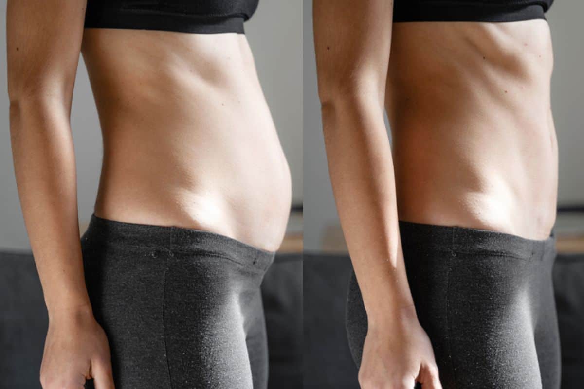 Post-Pregnancy: What Happens to Your Abdominal Muscles After Birth Greater London (Sutton)