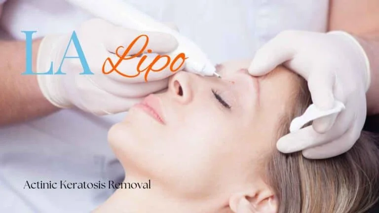 Woman receiving Actinic Keratosis Removal Treatment Greater London (Sutton)