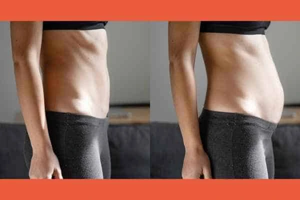LA-EMS Body Sculpting results Greater London (Sutton)