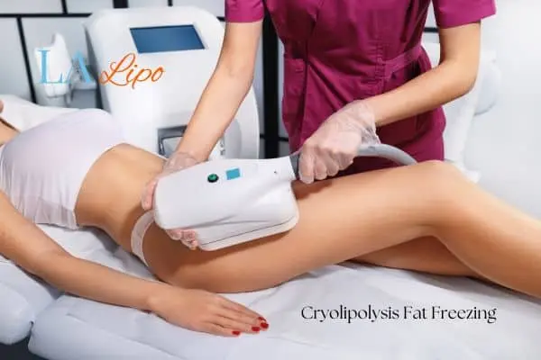 Woman receiving coolsculpting Greater London (Sutton) treatment on her thighs