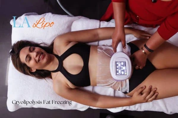 woman getting cryolipolysis Greater London (Sutton)