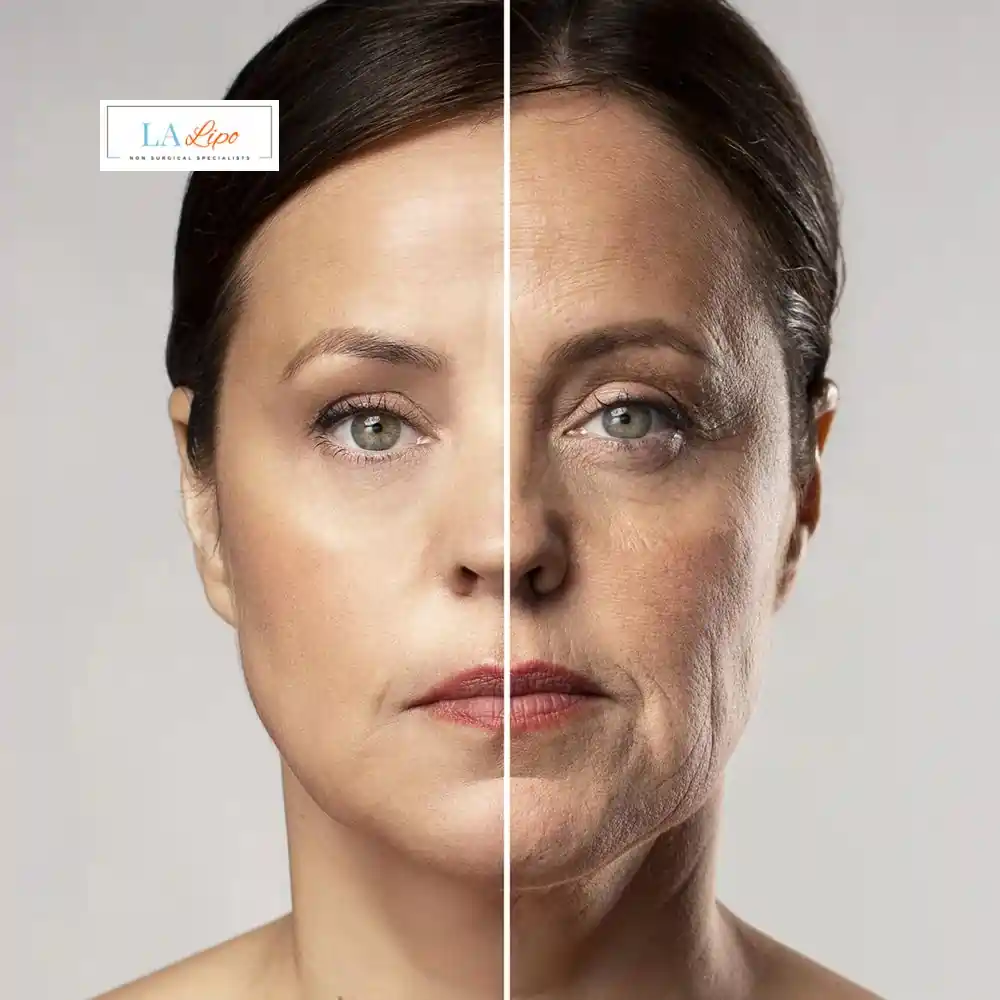 How Can You Tell If Non-Surgical Skin Tightening Is Right for You Greater London (Sutton)?