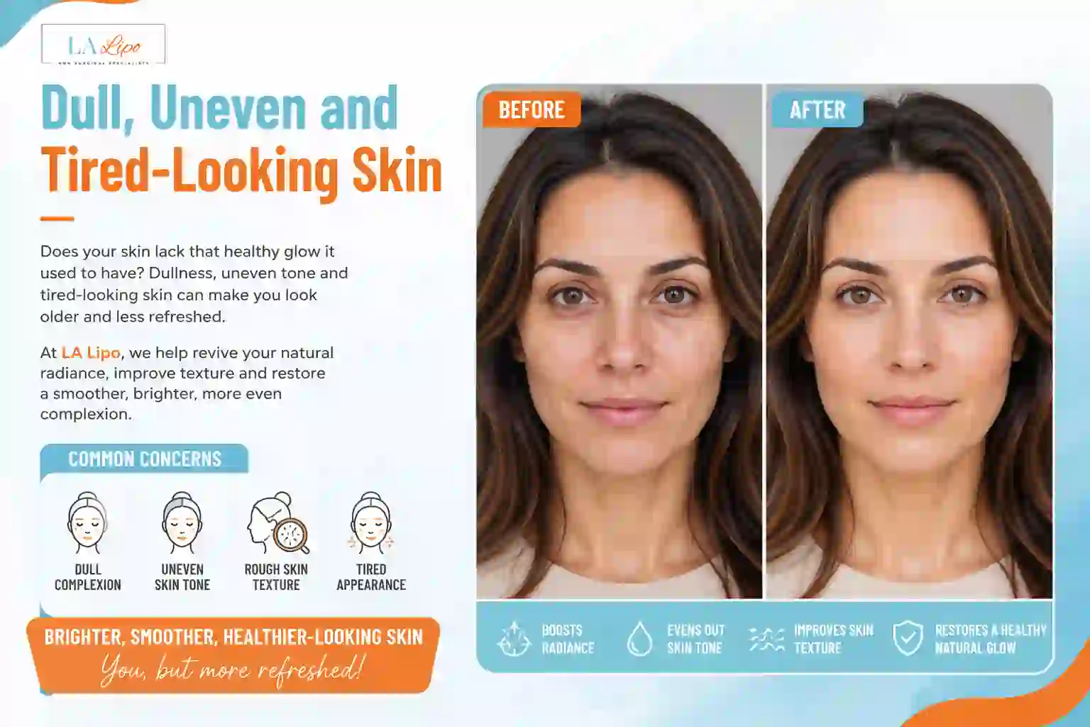 Sign #5: Dull, Uneven and Tired-Looking Skin Greater London (Sutton)