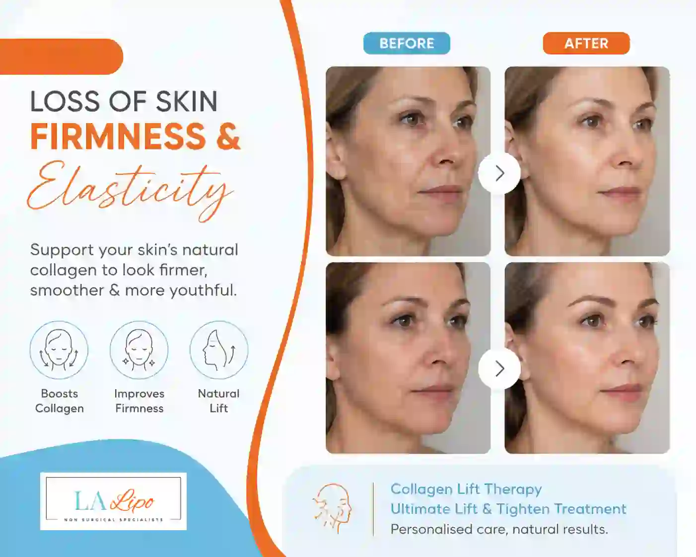 Sign #7: Loss of Skin Firmness and Elasticity Greater London (Sutton)