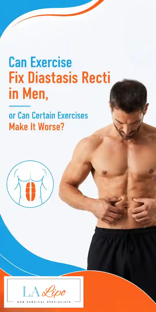 Can Exercise Fix Diastasis Recti in Men, or Can Certain Exercises Make It Worse Greater London (Sutton)?